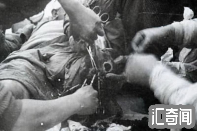 731部队的活体实验记录（731部队解剖真实影像）(1)